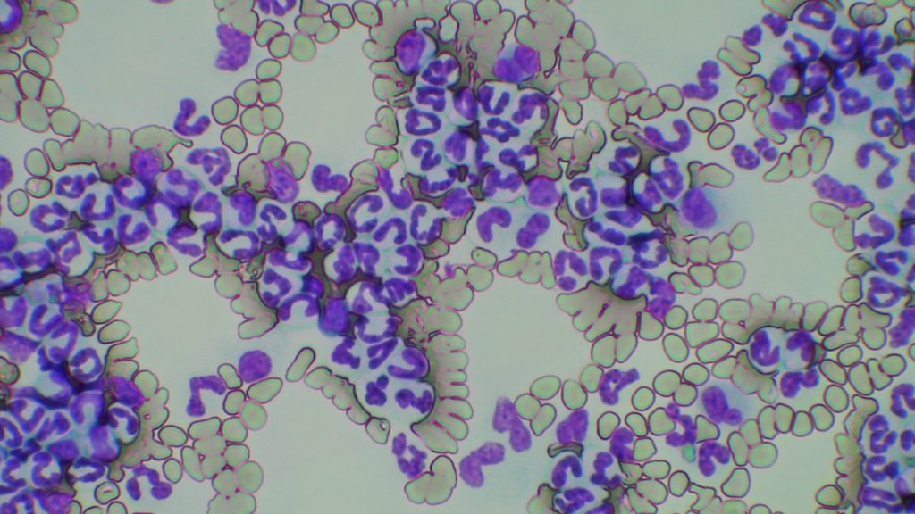 慢性骨髄性白血病犬猫の治療なら広島市konomi動物病院konomi動物病院